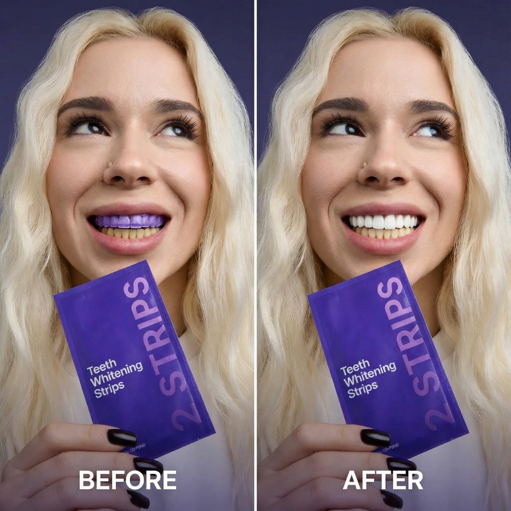 Purple Smile Boost Whitening Strips